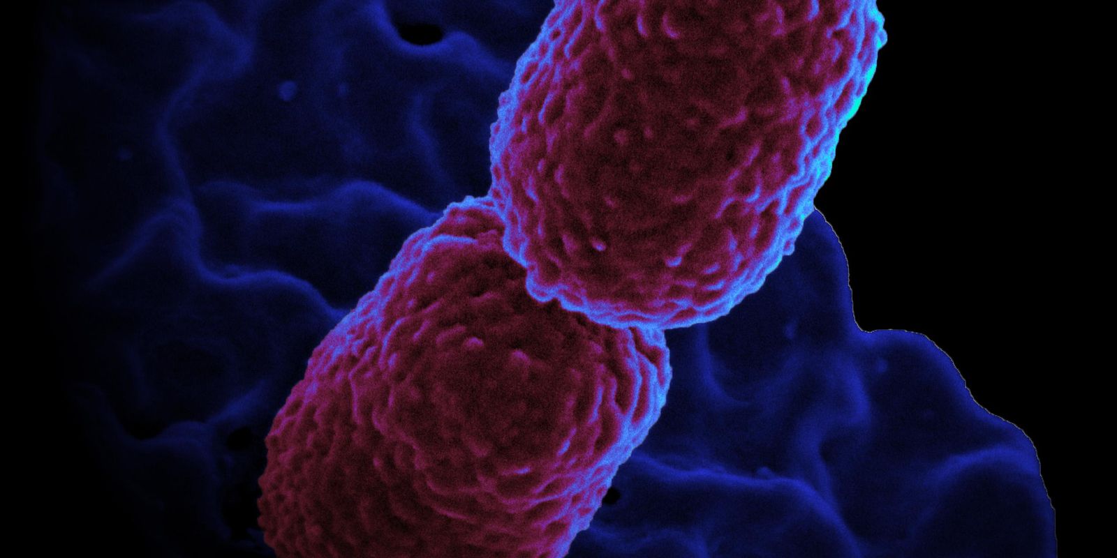 Hospital em Campinas restringe atendimento para conter superbactéria